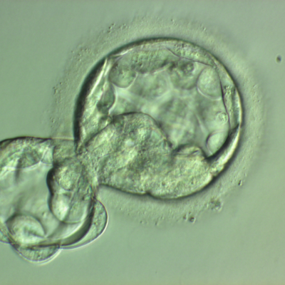 blastocyst 1